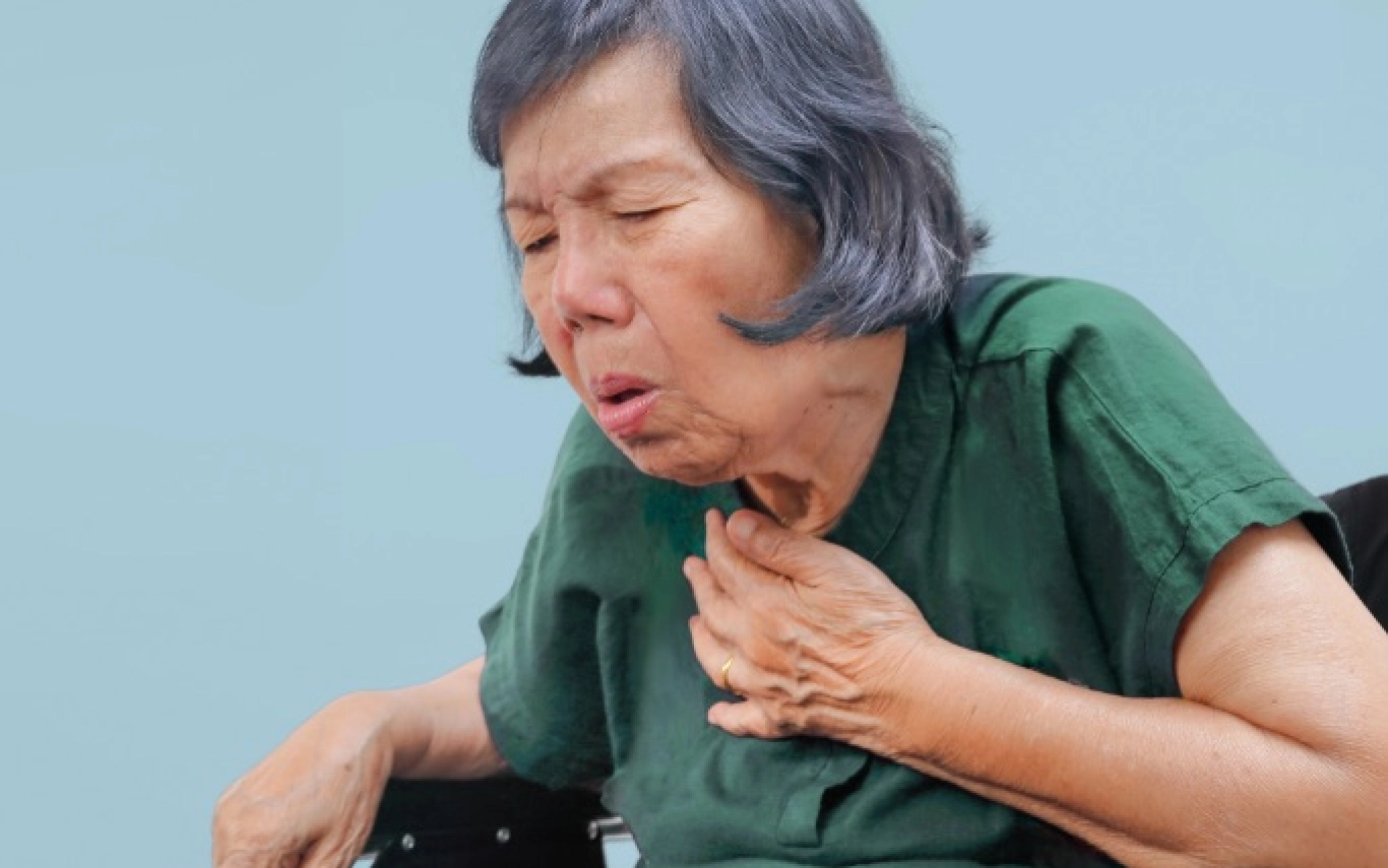 31 2a Chronic Cough